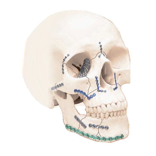 Sistem Medtrix Craniomaxillofacial