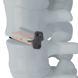 Trauhui Interbima Fusion Cage -Coales XL (xlif)