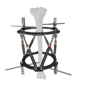 Praxui Titan-Dispundeval tashqi fiksatsiya qo'llab-quvvatlash