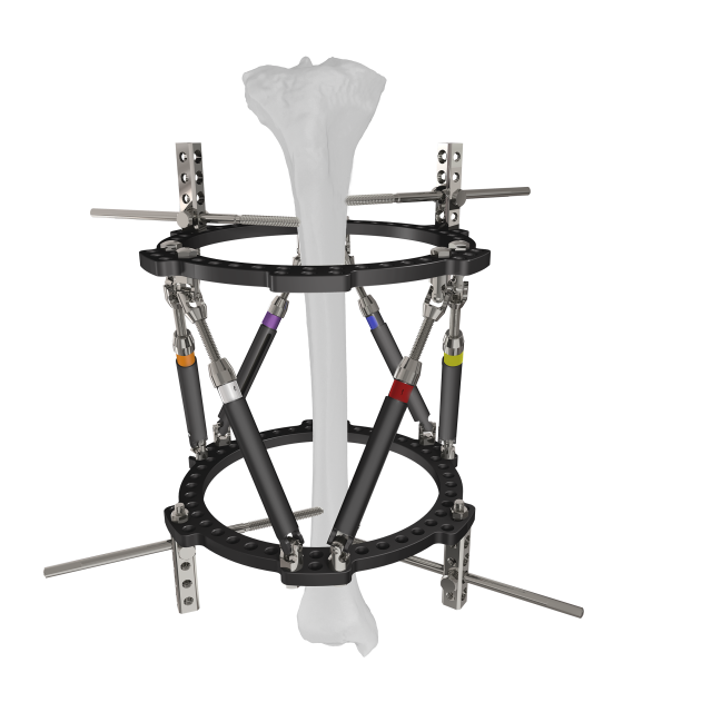 Trauhui Titan-Fix Circular External Fixation Support