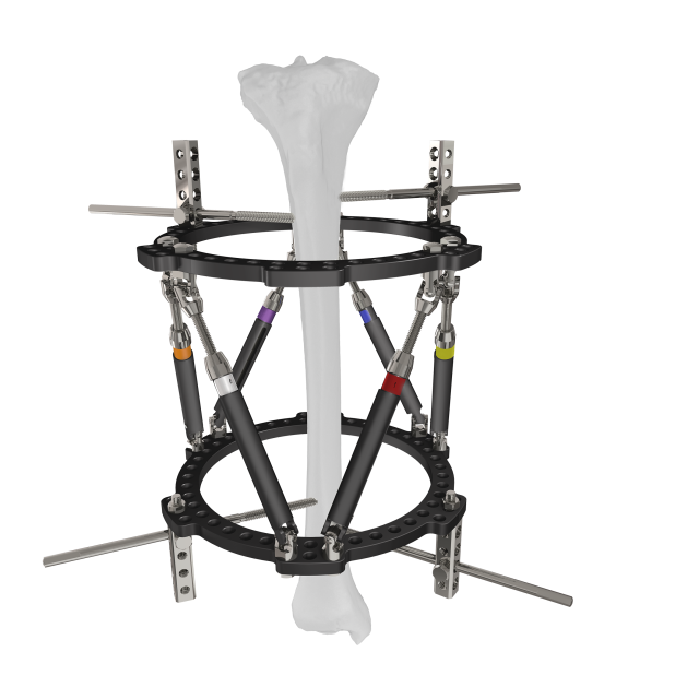 Trauhui Titan-Fix دعم التثبيت الخارجي الدائري