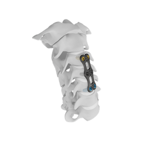 Camic Cervical Plate Systems-แผ่นปากมดลูกด้านหน้า